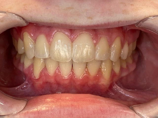 Case 10 after treatment
