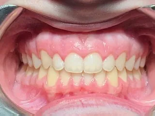 Case 5 after