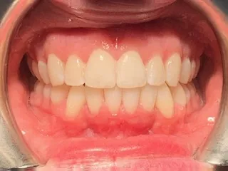 Case 7 after