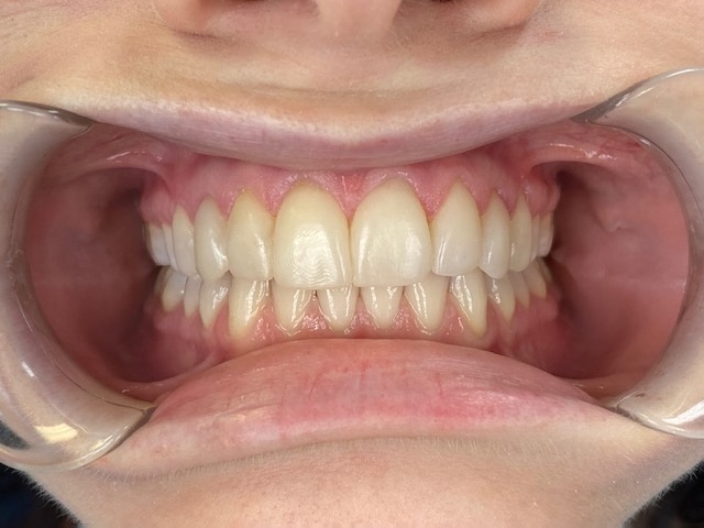 Case 8 after treatment