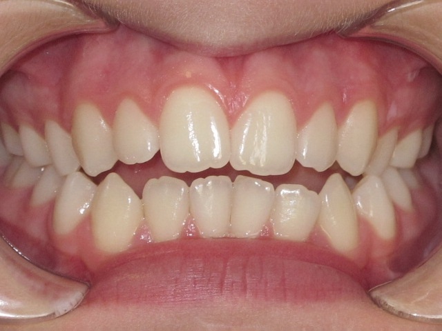 Case 1 before treatment