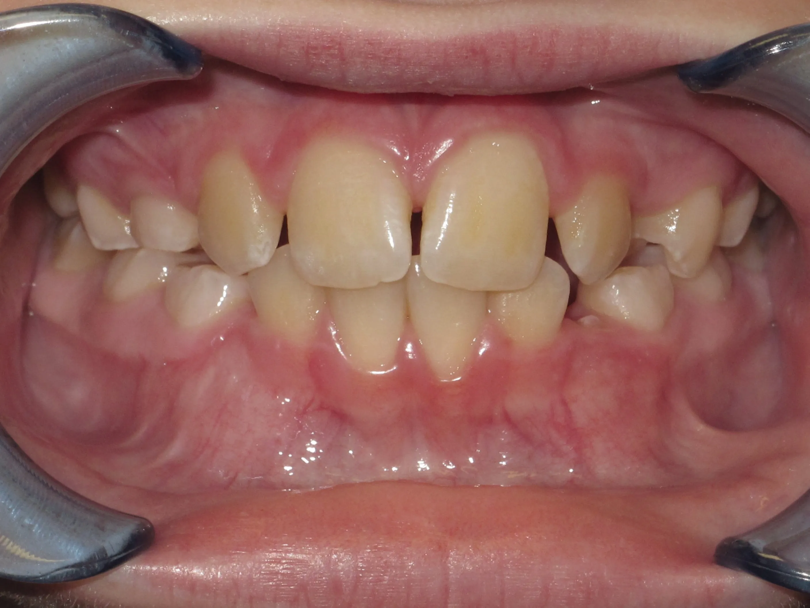 Case 10 before treatment