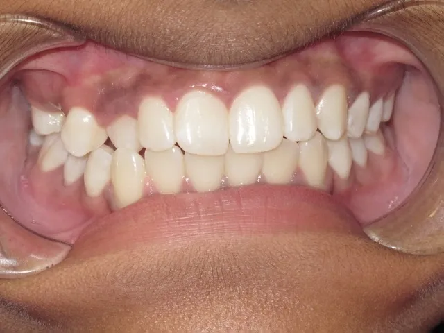 Case 4 before