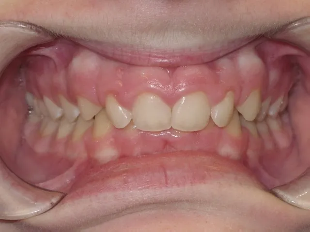 Case 5 before