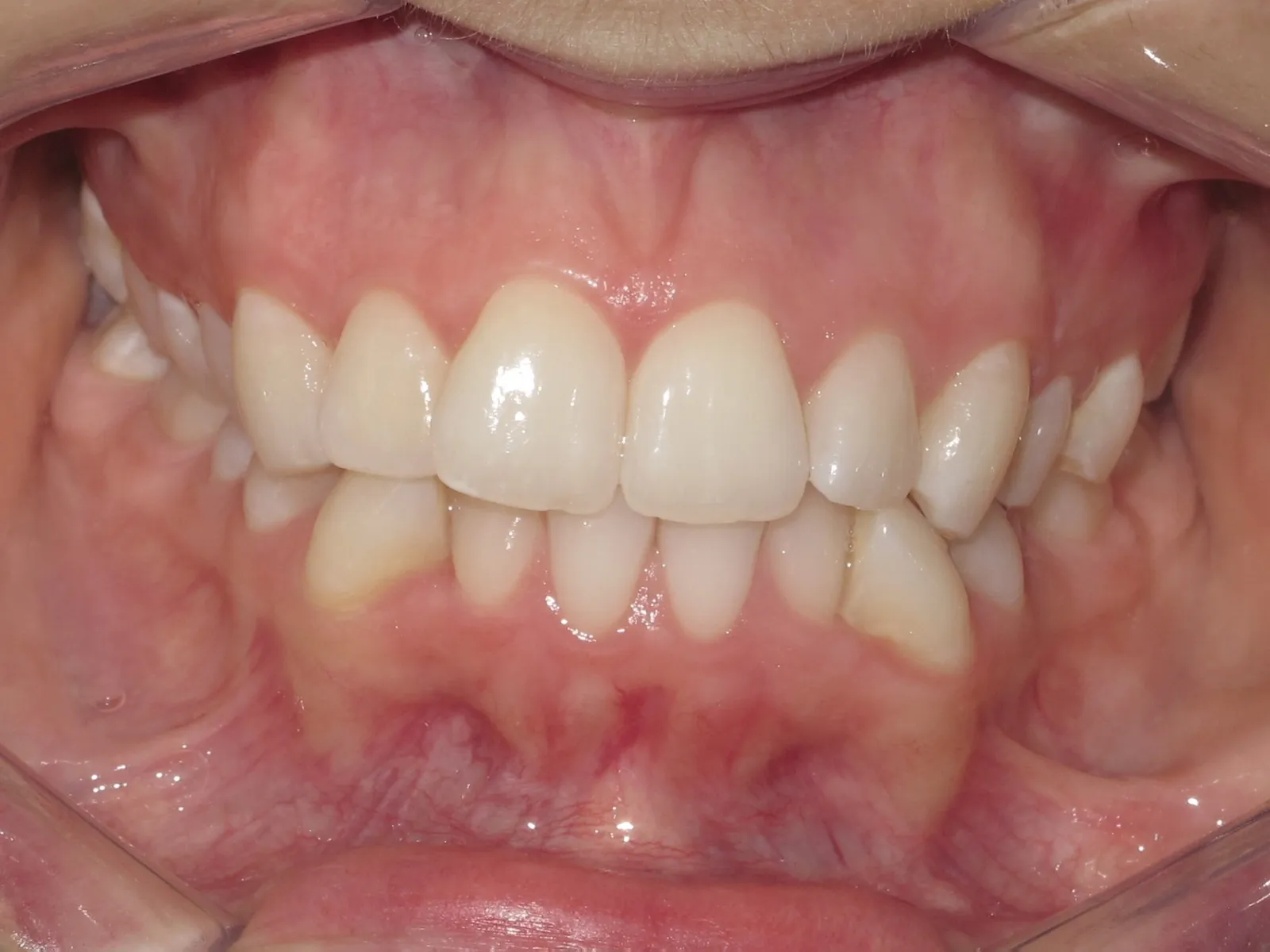 Case 7 before