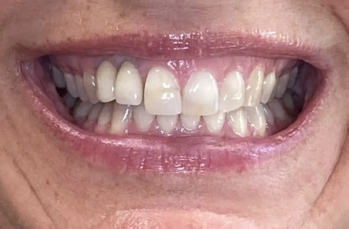 Case 9 before
